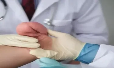 Doctor in gloves giving a prostate exam