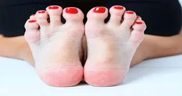 Chubby girl's feet up close with red painted toe nails